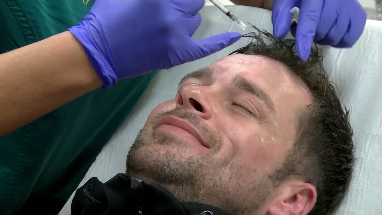 andriko-brotox-to-botox-poy-to-empisteyontai-gia-thn-gohteia-toys-mensdaygr